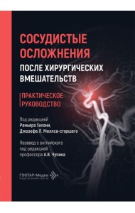 Сосудистые осложнения после хирургических вмешательств. Практическое руководство