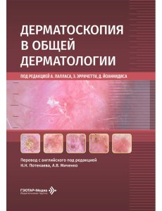 Дерматоскопия в общей дерматологии Дерматоскопия в общей дерматологии