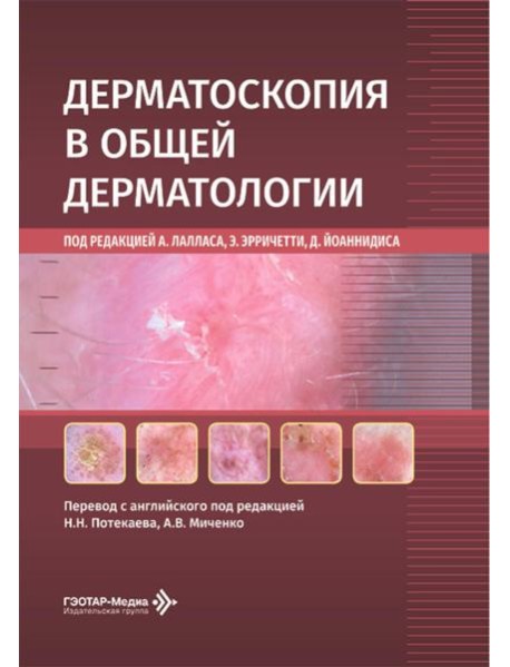 Дерматоскопия в общей дерматологии