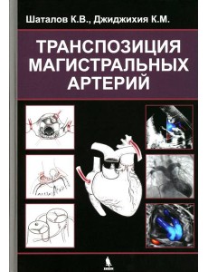 Транспозиция магистральных артерий