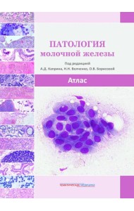 Патология молочной железы. Атлас