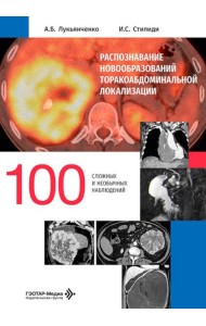Распознавание новообразований торакоабдоминальной локализации: 100 сложных и необычных наблюдений