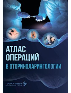 Атлас операций в оториноларингологии Атлас операций в оториноларингологии