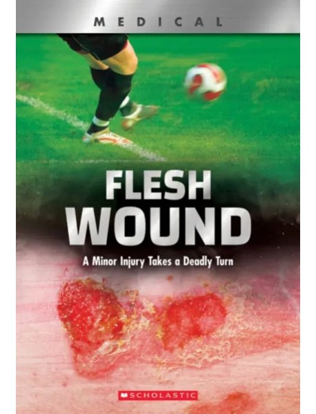 Flesh Wound
