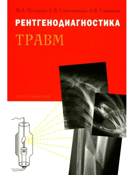 Рентгенодиагностика травм. Атлас-справочник