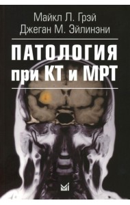 Патология при КТ и МРТ. 3-е изд