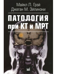 Патология при КТ и МРТ. 3-е изд