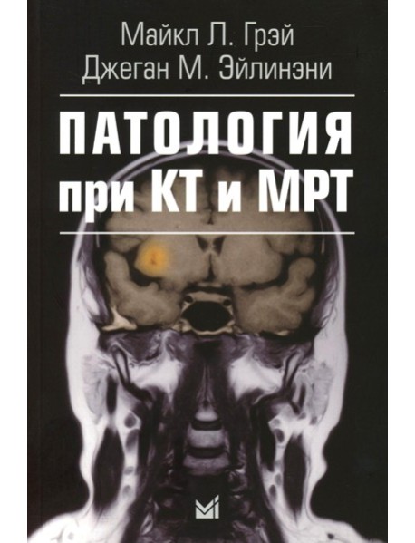Патология при КТ и МРТ. 3-е изд