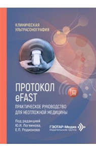 Протокол eFAST. Практическое руководство для неотложной медицины