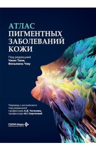 Атлас пигментных заболеваний кожи
