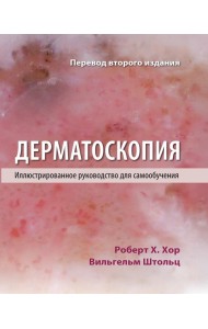 Дерматоскопия. Иллюстрированное руководство для самообучения