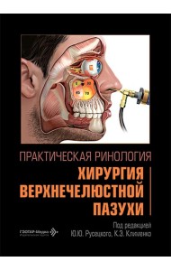 Практическая ринология: хирургия верхнечелюстной пазухи