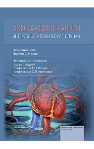 Эхокардиография. Интересные клинические случаи