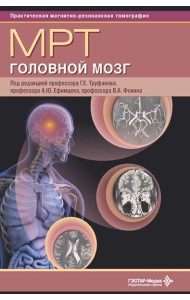МРТ. Головной мозг: руководство для врачей