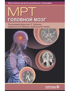 МРТ. Головной мозг: руководство для врачей МРТ. Головной мозг: руководство для врачей