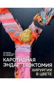 Каротидная эндартерэктомия. Хирургия в цвете