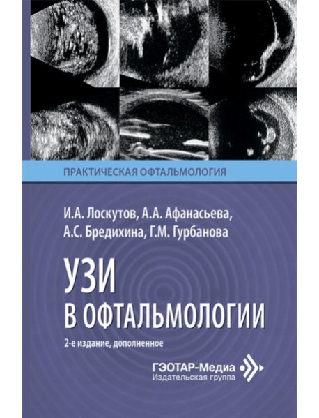 УЗИ в офтальмологии. 2-е изд., доп