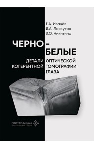 Черно-белые детали оптической когерентной томографии глаза